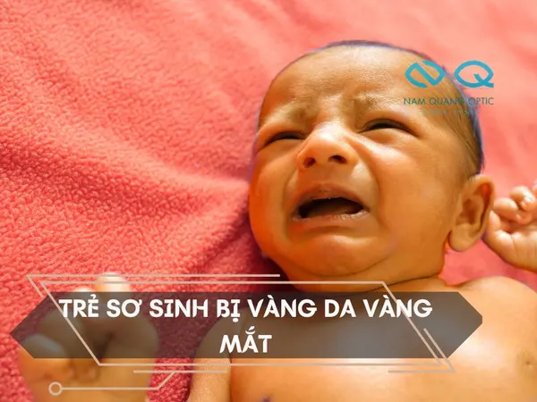 Trẻ sơ sinh bị vàng da vàng mắt nguyên nhân do đâu? Có nguy hiểm không?